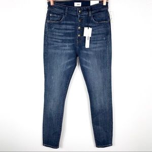m1858 Alice High-Rise Button-Fly Ankle Jean